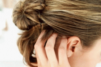 dermatite seborroica cuoio capelluto - capelli - viso - prodotti